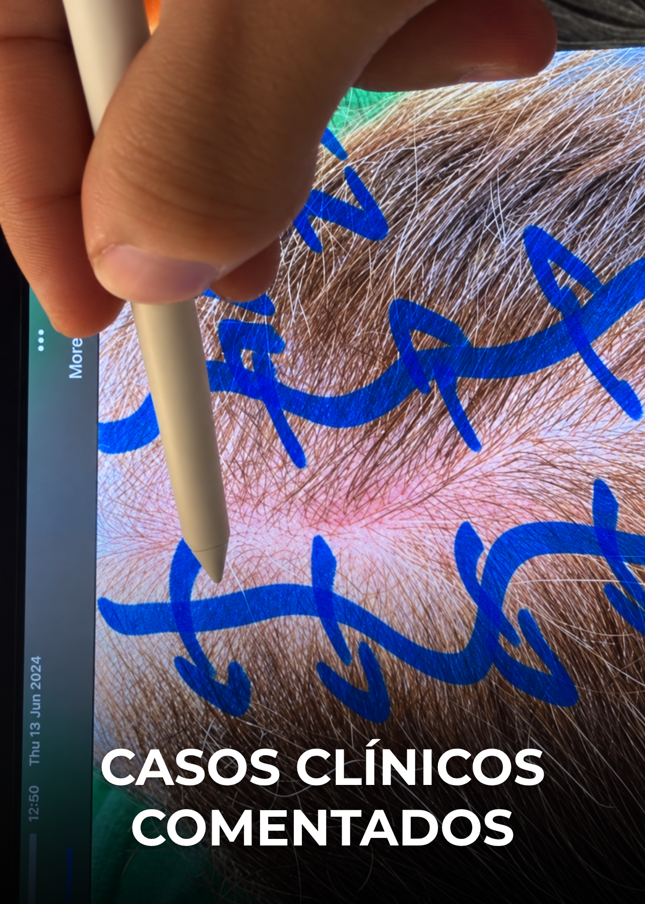 Casos clínicos comentados